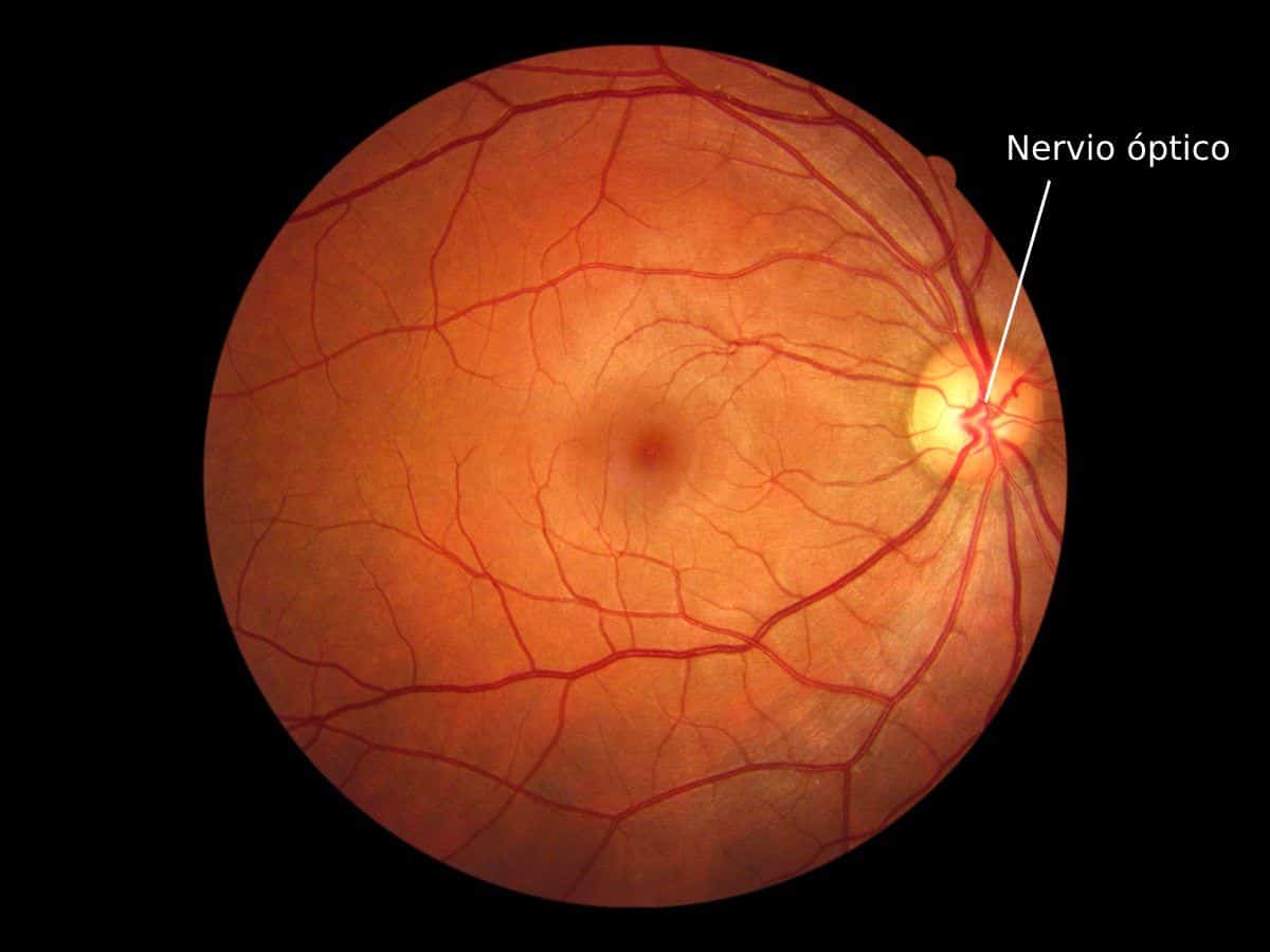 ¿Tiene cura el nervio óptico dañado?