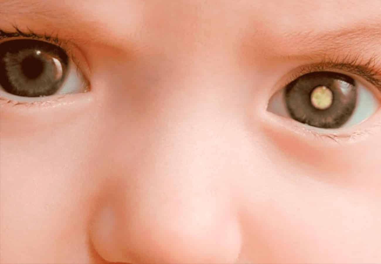 weiße Pupille
